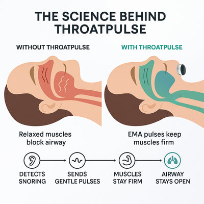 ThroatPulse Anti-Snoring Device