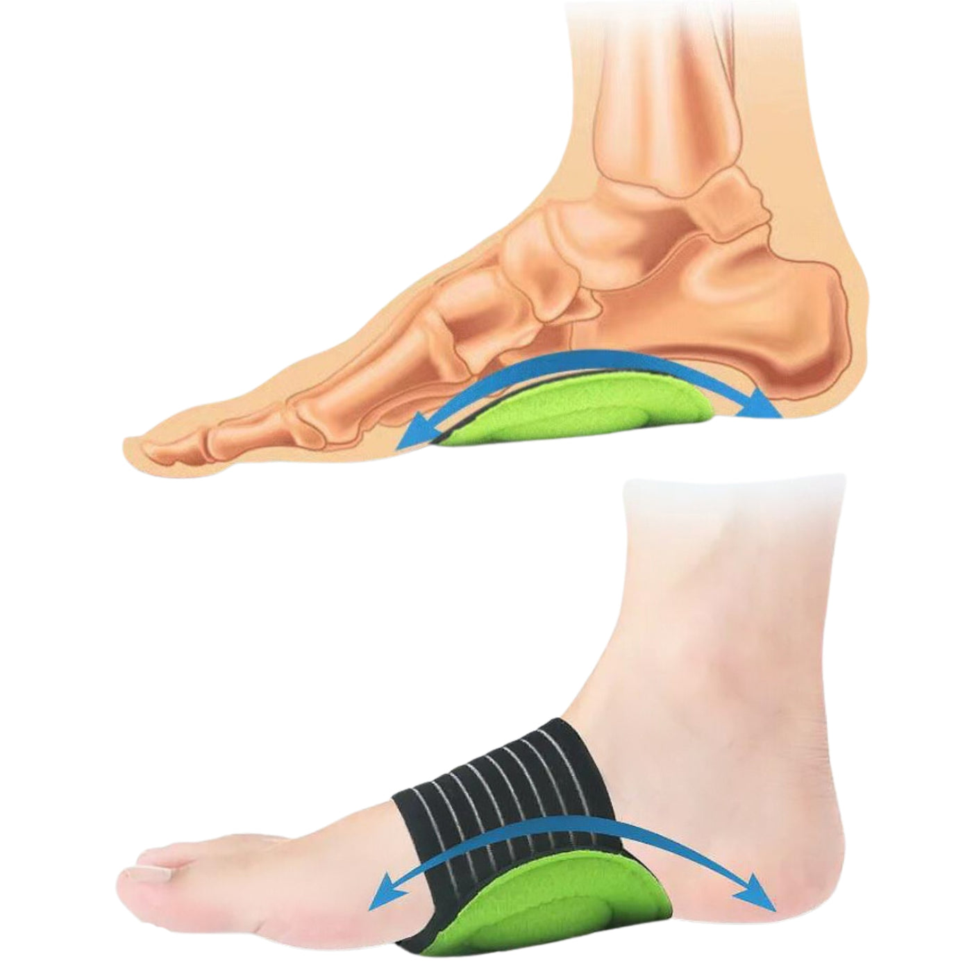 Springer Arch Support Brace – Healthy Lab Co